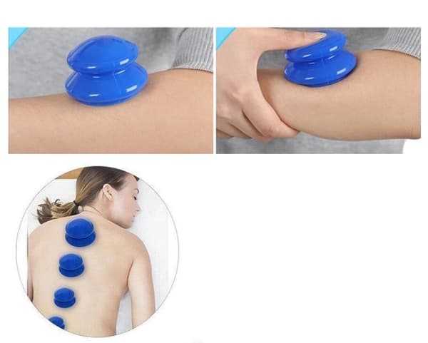 Silikone massagekopper, blå - cupping sæt
