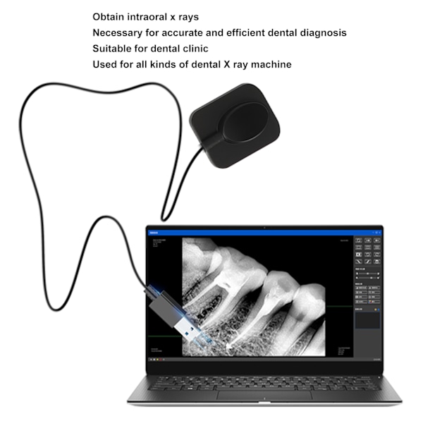 Professionellt Dental Intraoralt Sensorförstoringsendoskop, Portabelt Mikroskop Högkvalitativ Optisk Lins för Exakta Dentaldiagnoser och