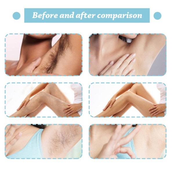 Permanent hårborttagning spray smärtfri hårborttagare för damer armhåla ben  armar hår tillväxthämmare 5a40 | Fyndiq