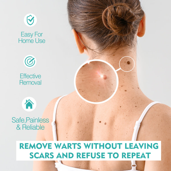 Skin Tags Remover Smärtfri Skin Dark Spot