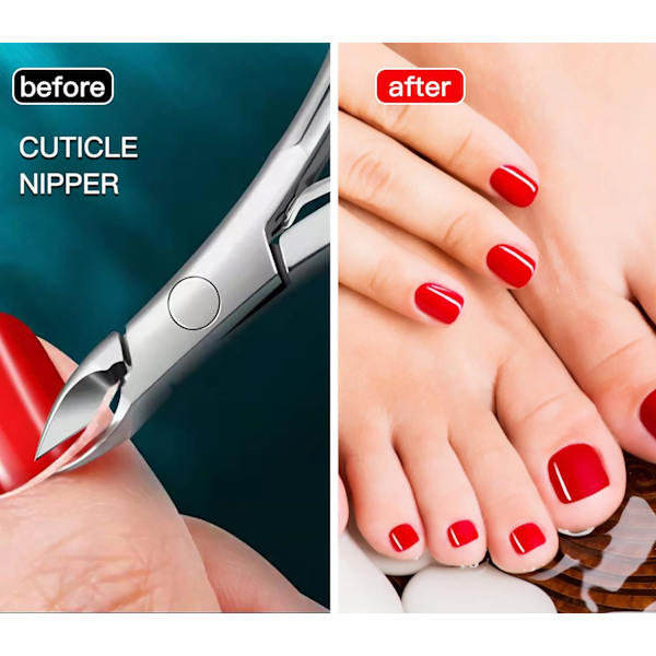 Professionell nagelbandsnångare Nagelbandstryckare i rostfritt stål Nagelband