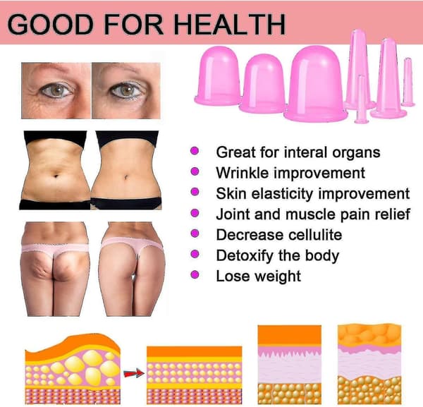 7 st/ set Silikon Anti-cellulitkopp Vakuumterapi Kroppssmärtlindring Massageburkar Anticelluliter Röd