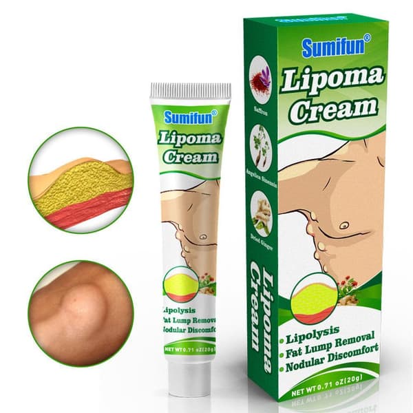 Lipomas Creme Antibakteriel Rensende Cellulite Fedtfjernelse 20g Knude S8Q8