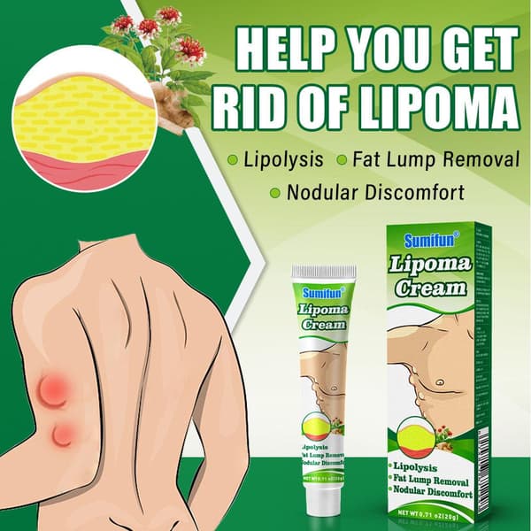 Lipomas Creme Antibakteriel Rensende Cellulite Fedtfjernelse 20g Knude S8Q8