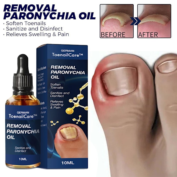 2023 Bästa Tyska NagelVård NagelProp Anti Paronychia Lindring Olja_ blueA 10ml