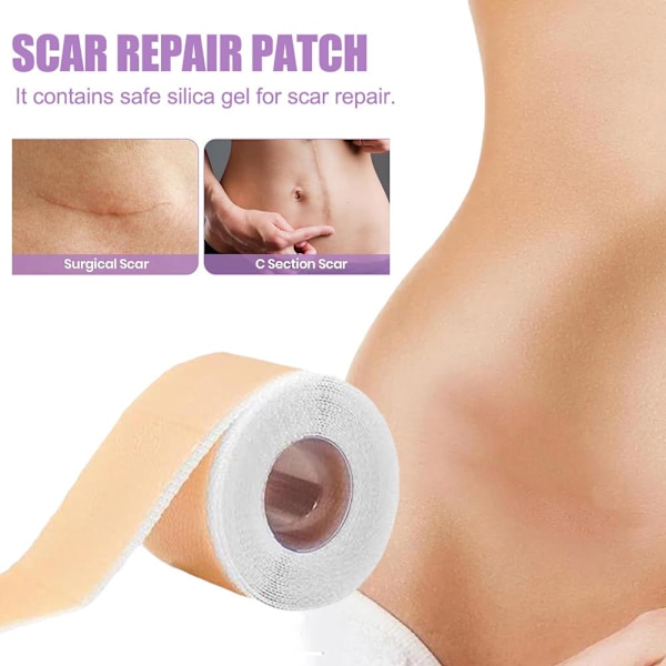 Hyperplasi Sektion Reparationsplåster Silikongel Osynlig Graviditet 4*30cm 1pcs