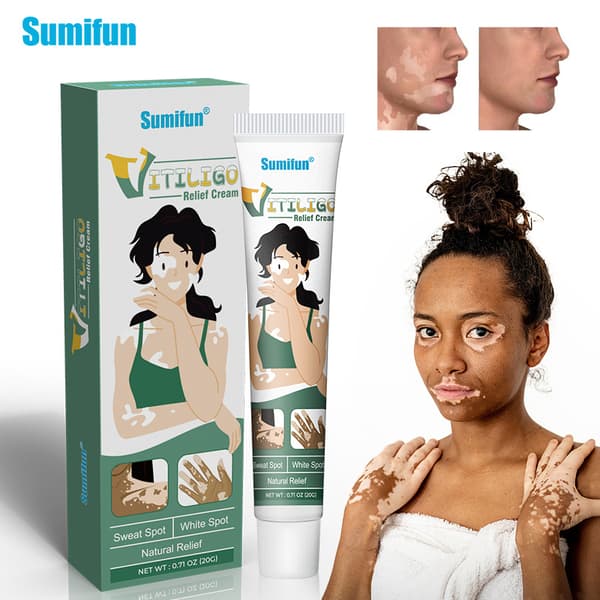Vitiligo Kräm Serie Hudrengöring och Hälsovårdskräm K10046