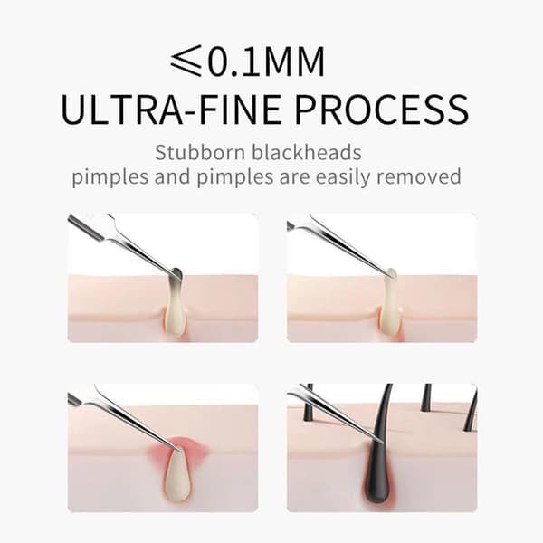 Ansigts Blackhead Remover Sæt, Professionel Blackhead Remover PincetA