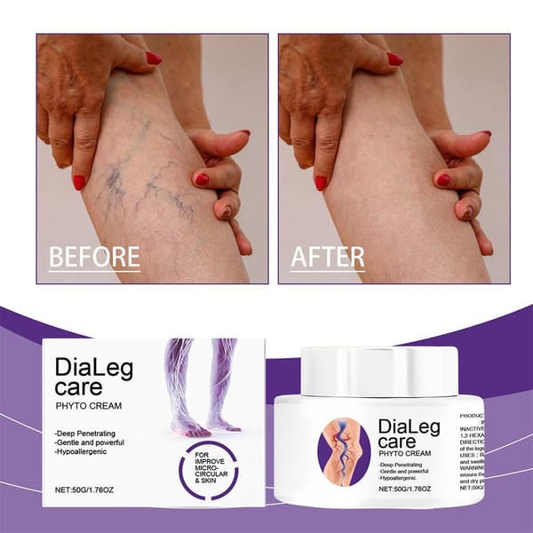 DiaLeg Care Cream, Avancerad Multi-Ceramid Nattkräm, Åderbråckskräm