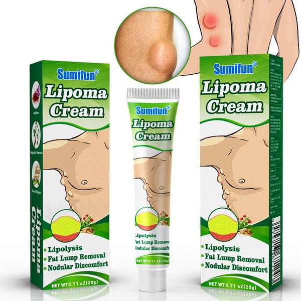 Lipomas Creme Antibakteriel Rensende Cellulite Fedtfjernelse 20g Knude S8Q8