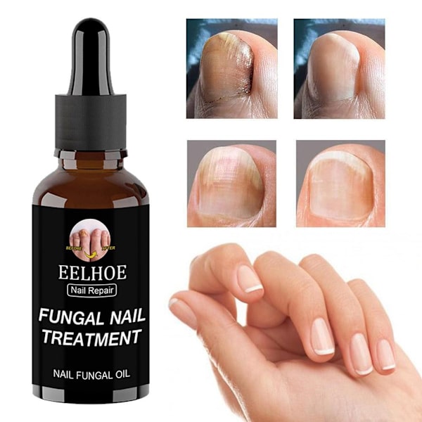 50ml EELHOE Nagelvårdslösning För Förtjockning Och Uppljusning Av Naglar Tar Bort Grå Och Döda A1X5 brownA 30ml