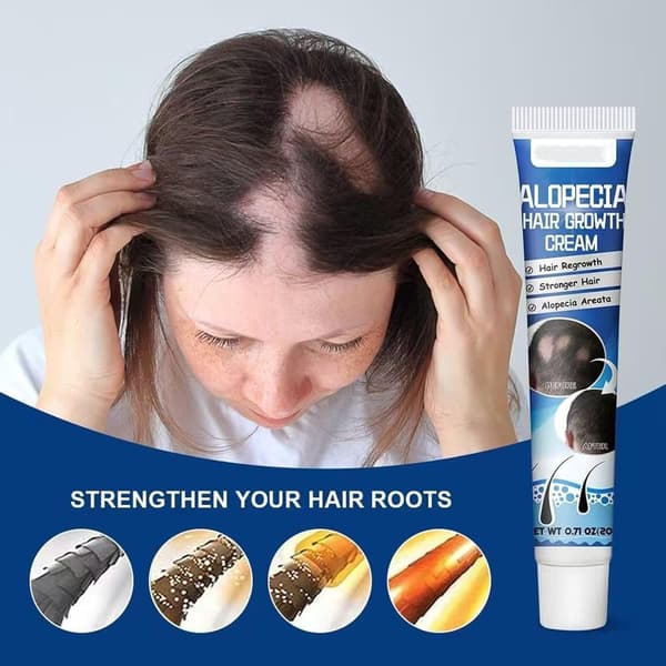 Alopecia Hårväxtkräm