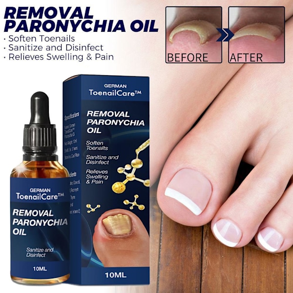 2023 Bästa Tyska NagelVård NagelProp Anti Paronychia Lindring Olja_ blueA 10ml 5pcs