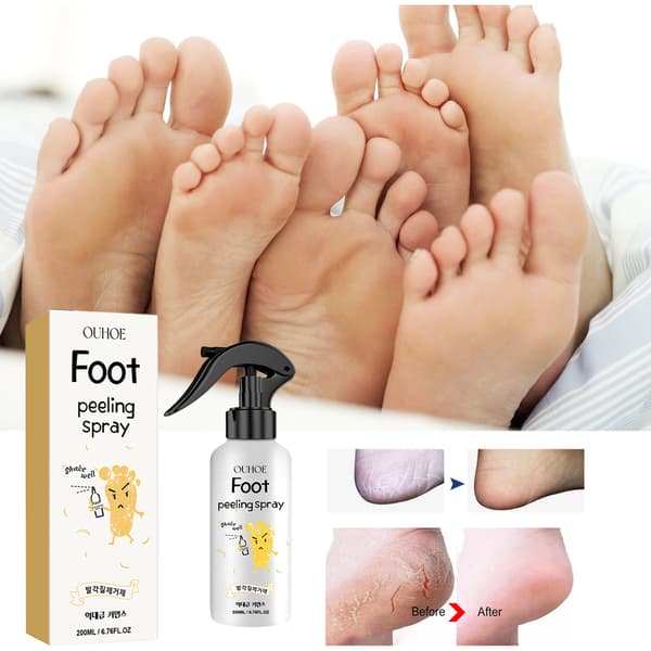 Soft Feet Solution Jalkahoitosuihke - 200ml Puhdistaa ja kosteuttaa hellävaraisesti