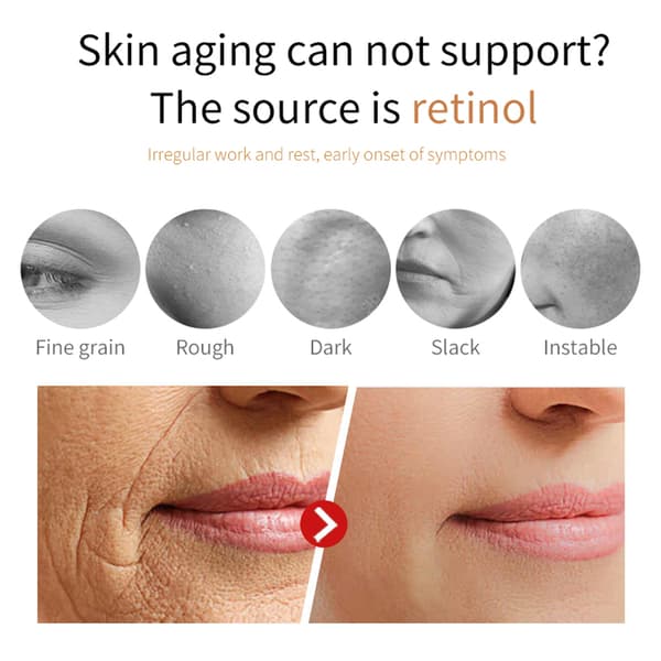 Retinol ansiktsstrammende krem strammer opp og glatter ut huden, reduserer fine linjer og rynker, og løfter ansiktskonturene.