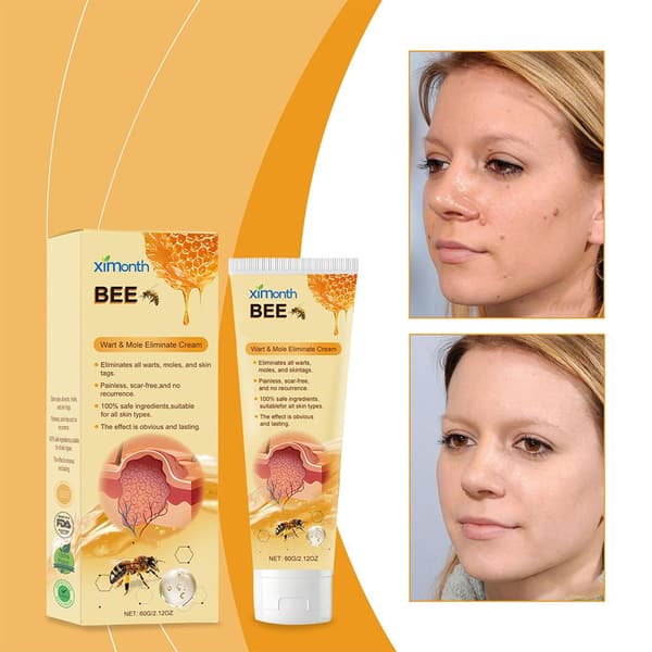 BeeVenom Modermærke- og Vortebehandlingscreme, 60g Hurtig Vortedfjernelse Bedste Creme G59C