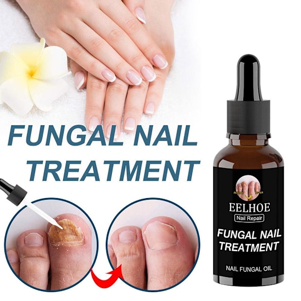 50ml EELHOE Nagelvårdslösning För Förtjockning Och Uppljusning Av Naglar Tar Bort Grå Och Döda A1X5 brownA 30ml