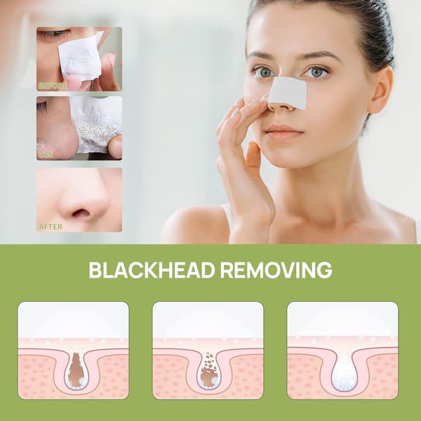 Hudormefjerner - Peel Off Maske til Næse & Ansigt, Sæt til Fjernelse af Hudorme 1.05oz