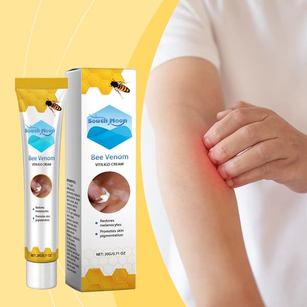 Bivengift vitiligo behandlingskräm bleker fläckar, jämnar ut hudtonen och återfuktar huden.