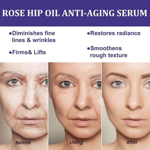 Hybenolie Ansigts Serum: Lysner, blødgør, reducerer mathed, mindsker fine linjer og opstrammer huden.