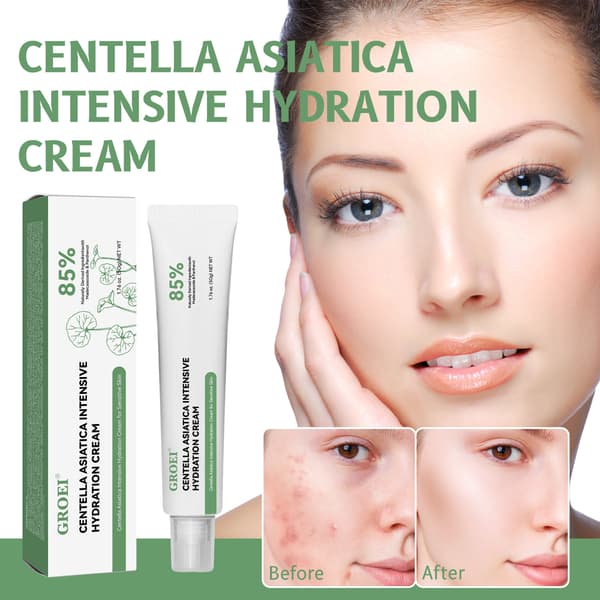 Fuktighetskrem (Centella Asiatica Intensiv Fuktighetskrem 50g - Varmt Selgende Vare)
