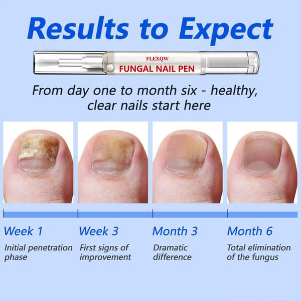 Kynsinauhaöljykynä käsienhoitoon - 3ml