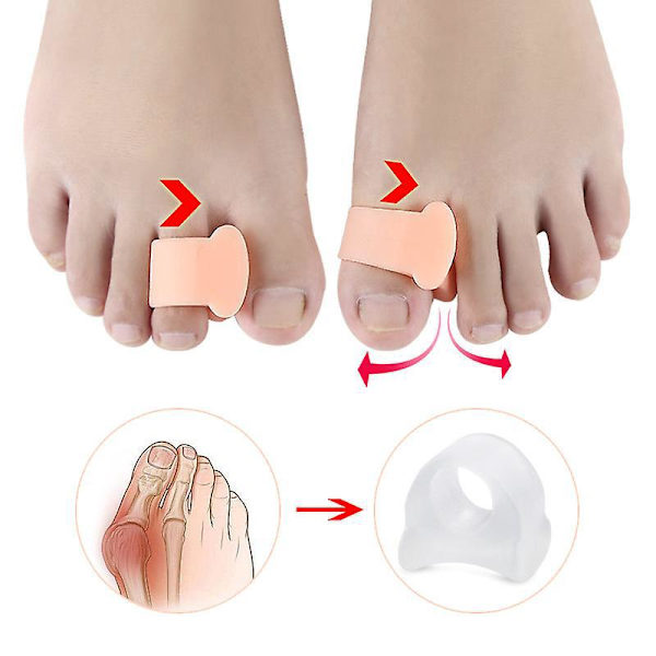 Gel Tåseparatorer til Overlappende Tæer - 6 Pak (Beige)
