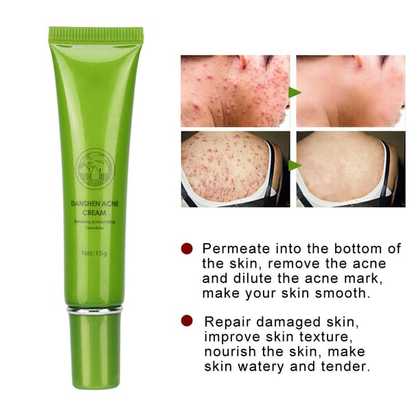 MABREM Acnefjernelsescreme Hudormefjernelse Fugtgivende Forfriskende Lotion