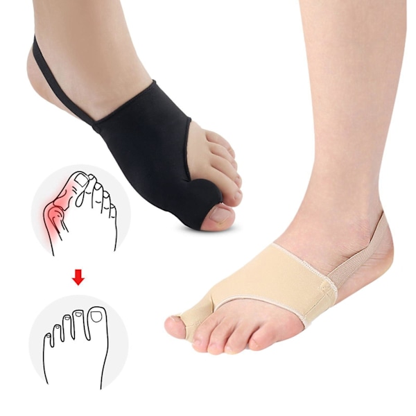 Hallux Valgus-korrigerare, stortåskydd, justerbart band, hallux valgus-dyna, smärtlindring, svart beige