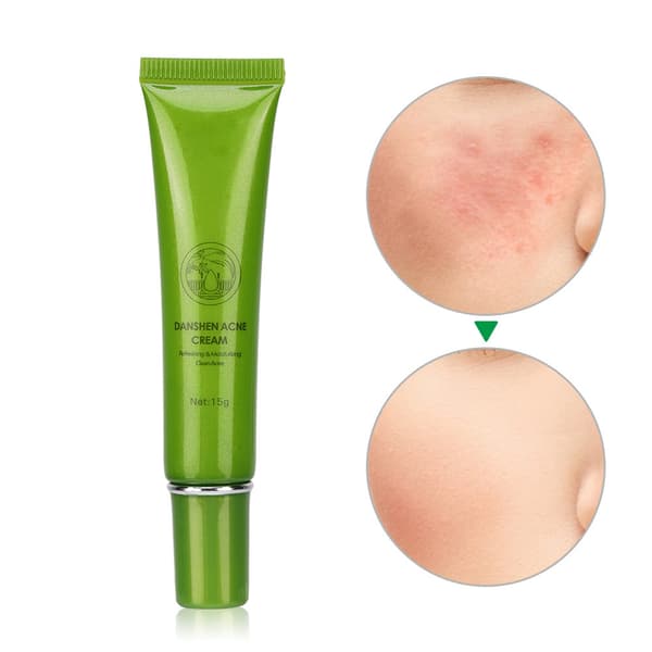 MABREM Acnefjernelsescreme Hudormefjernelse Fugtgivende Forfriskende Lotion