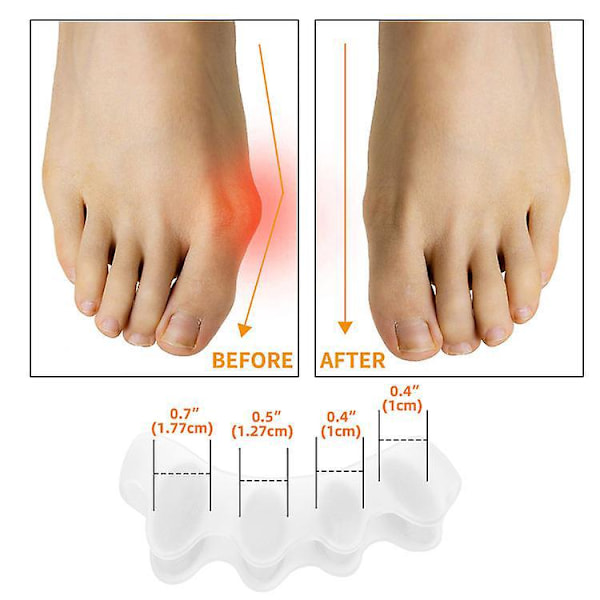 Silikon Tåavdelare för Hallux Valgus och Hammare Tå Rättning - 3 Par