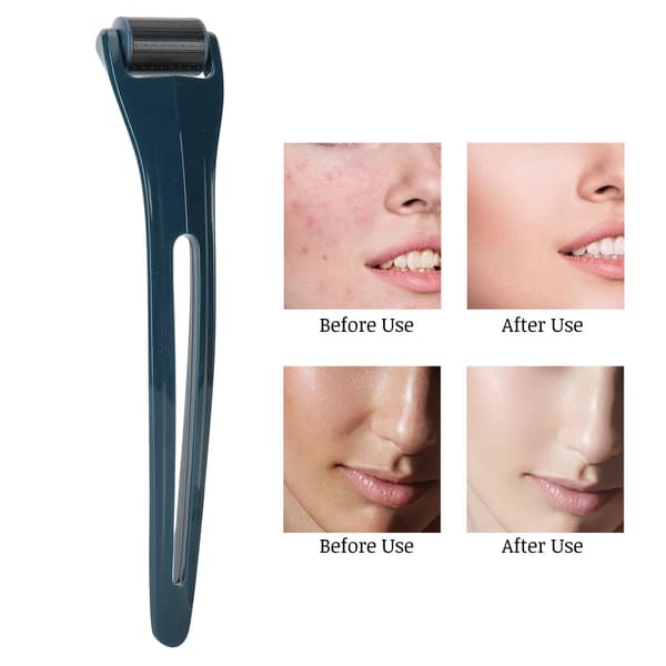 Ansigtsmassagerulle DRS128_0.5mm Mikronåleterapi Rynkefjernelse Ansigtsplejemassager