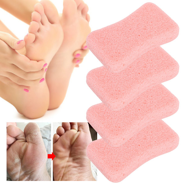 4 stk Callus Exfoliate Stone Fødpleje Pimpsten Fødder Hård Hud Fjern Pedicure ScrubberPink