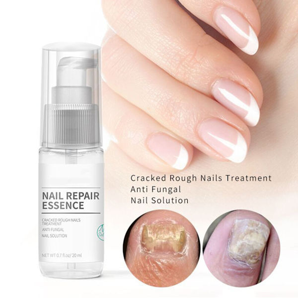 Nail Care Liquid Exfoliate Improve Halkeilevia ja karkeita kynsiä korjaava geeli sormenkynsille varpaankynsille 20 ml