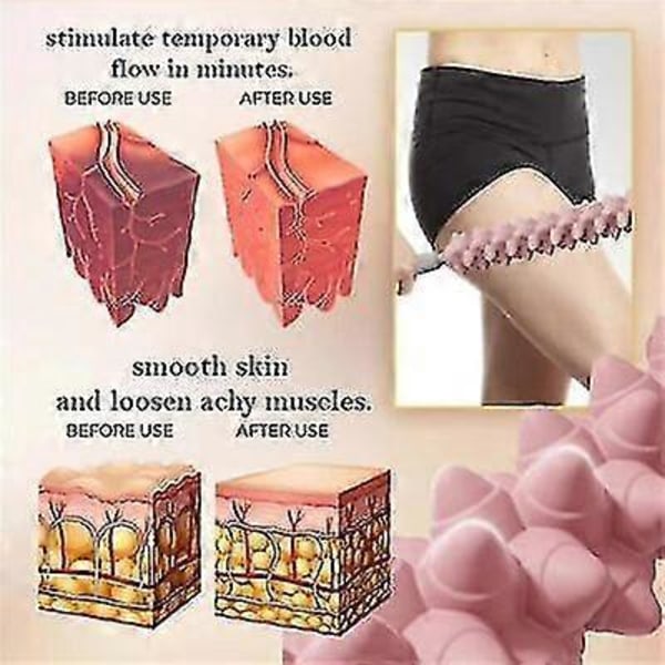 Fascia Cellulite Blaster, Smertelindring Myofascial Release -DGZD A lilla