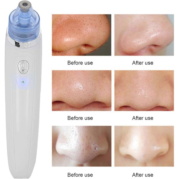 Pore Vacuum, Ansikts Pore Cleanser, USB-lading Elektrisk Blackhead Remover Sugeinstrument Pore Cleanser v