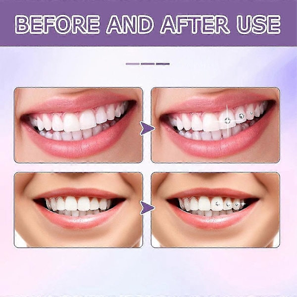 Ammattimainen DIY Hammaskoruliima - 1/2kpl 7ml, UV-valolla kovettuva 1kpl