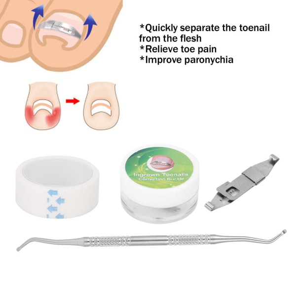3st inåtväxande tånagelkorrigerare Paronychia-behandling Nagelkorrigeringsspänne Set