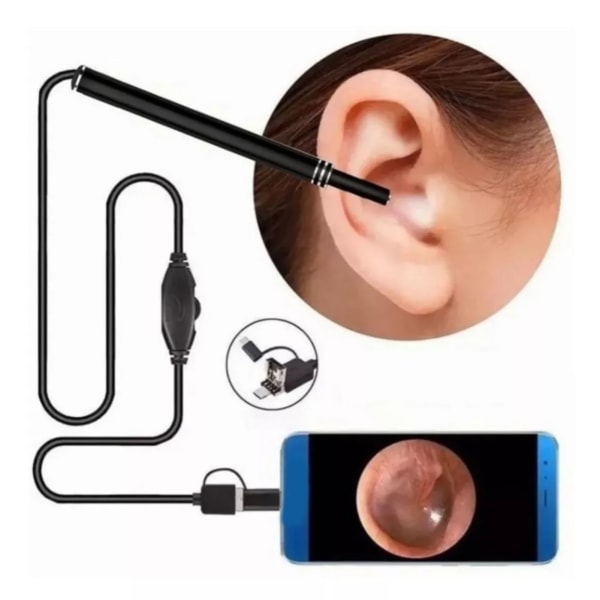 Digitaalinen otoskooppikamera Ultra Clear View 6 LED-valoa IP67 Vedenpitävä Korva-endoskooppi Androidille OTG Musta 5,5mm