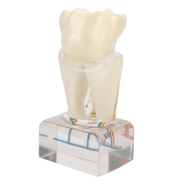 Professionel tandnervemodel demonstrationsmodel til tandlægeundervisning