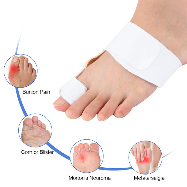2st Vuxen knystkorrigerare Ortopediska tåavskiljare Hallux Valgus Ortos Utrustning för Kvinna Dag/Natt Använd Vit