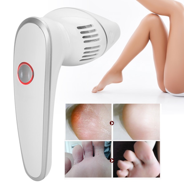 Elektrisk fodfil Callus Remover Vandtæt Justerbar Dead Skin Remover Pedicureværktøj (sølv)