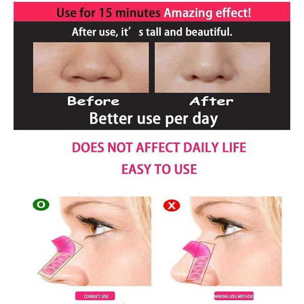 10 stk Magic Nose Up Lifting Clips for slankere og rettere nesebro - Gummiformer, smertefritt skjønnhetsverktøy
