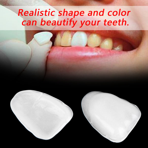 70 kpl pussihartsiyläinen väliaikainen hampaiden kruunu hampaiden suun hoitoon (valkoinen yläosa)