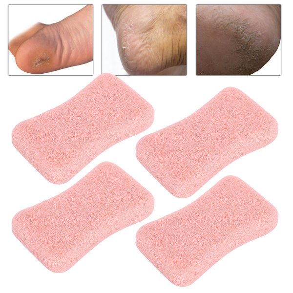 4 stk Callus Exfoliate Stone Fødpleje Pimpsten Fødder Hård Hud Fjern Pedicure ScrubberPink