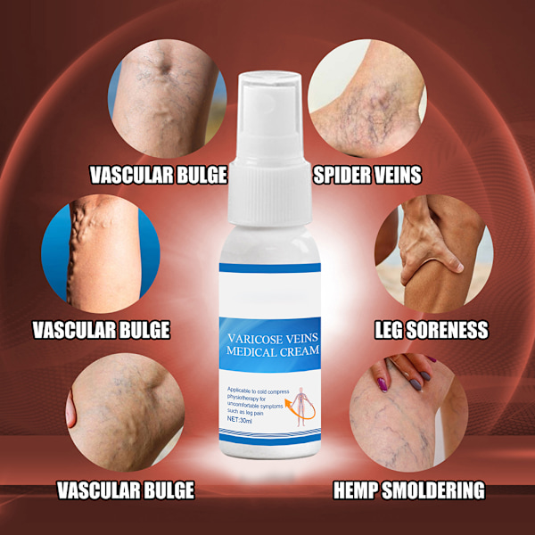 Åreknudespray Antiinflammatorisk Effektiv Åreknudespray