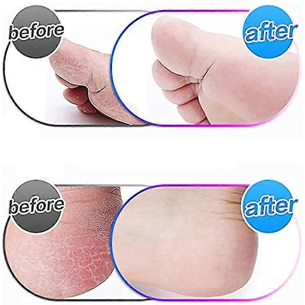 Emjoi Micro Pedi Ersättningsrullar - Extra Grov [4-pack]