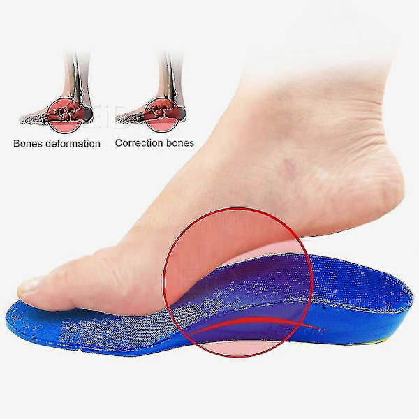 Børne Orthotics Indlægssåler til Platfod Støtte Korrektion Fodpleje til Børn Ortopædiske Indlægssåler Sko Indlæg EU30-32 20.5cm