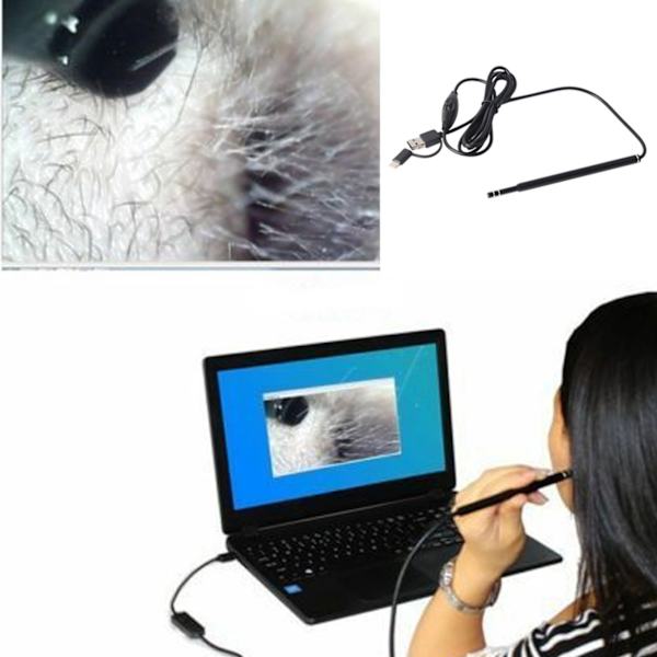 Ear Pick Wax Remover Cleaner Scope Endoskop Earpick Kamera Öronvårdsverktyg