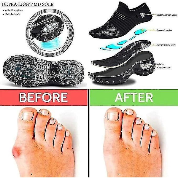 Ortopædiske Diabetes Luftpude Slip-on Vandresko Lysegrå EU 40